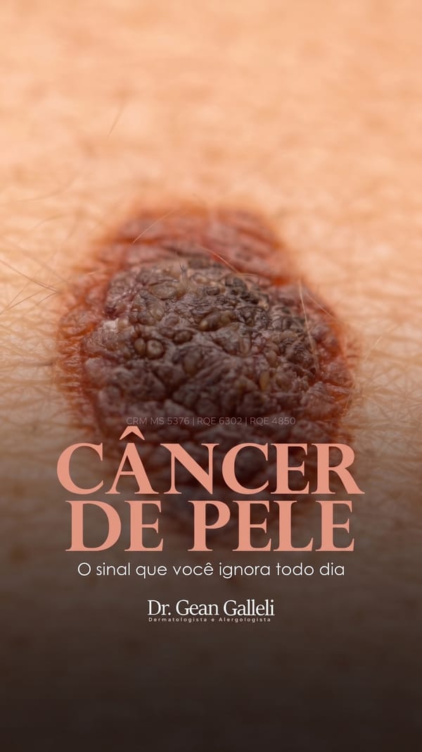 Gean Galleli - Câncer de Pele